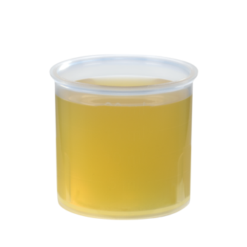 Schoenenberger Zwiebel